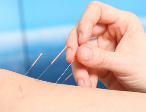 Dry Needling FAQs