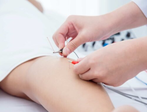 Difference Between Dry Needling And Acupuncture