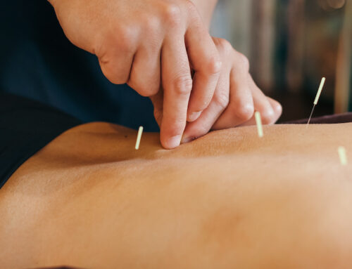 What is Dry Needling Really Like?